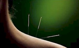 What is Acupuncture and how does it work?